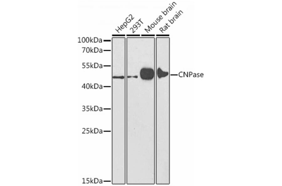 Western Blot - Anti-CNPase Antibody (A308860) - Antibodies.com