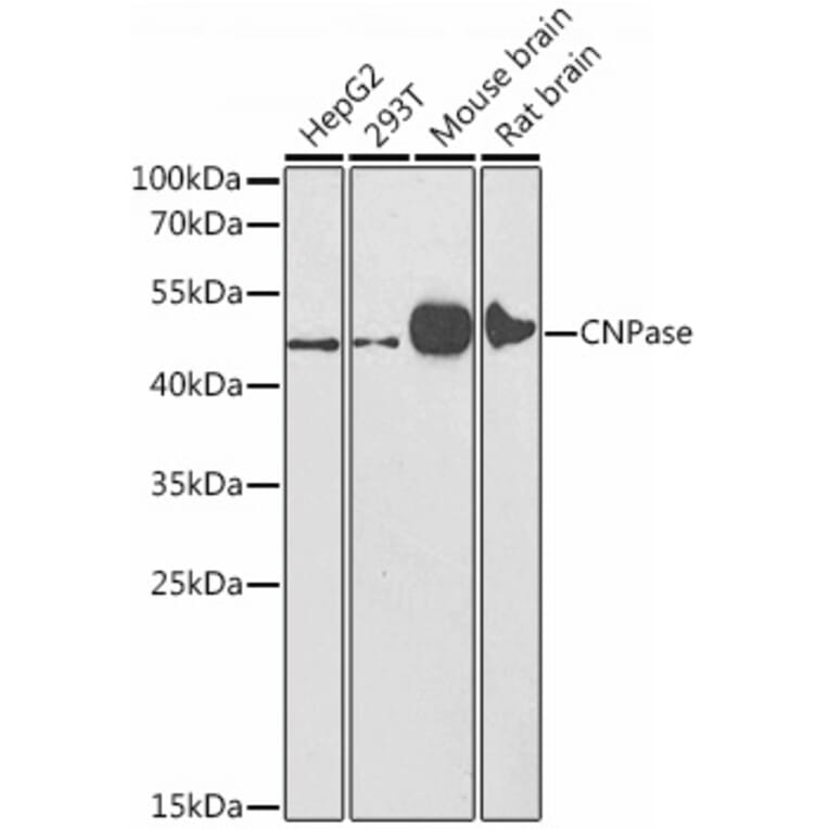 Western Blot - Anti-CNPase Antibody (A308860) - Antibodies.com