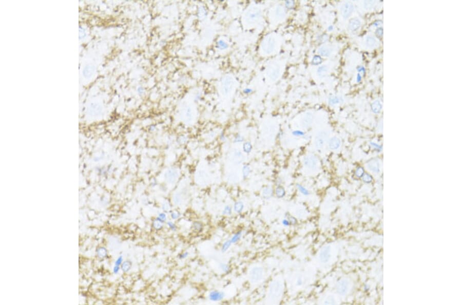 Immunohistochemistry - Anti-CNPase Antibody (A308860) - Antibodies.com