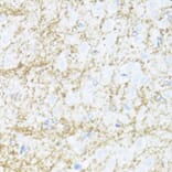 Immunohistochemistry - Anti-CNPase Antibody (A308860) - Antibodies.com