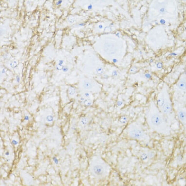 Immunohistochemistry - Anti-CNPase Antibody (A308860) - Antibodies.com