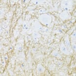 Immunohistochemistry - Anti-CNPase Antibody (A308860) - Antibodies.com