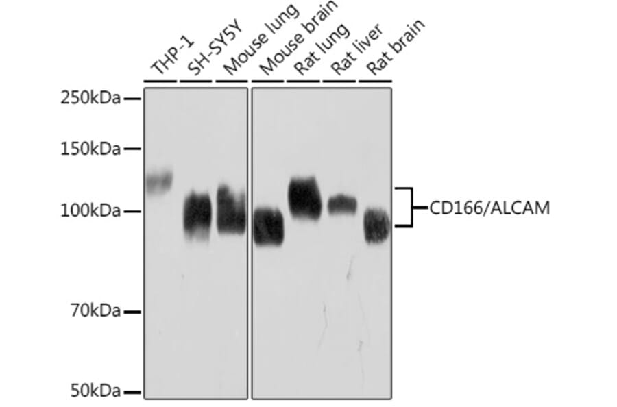 Western Blot - Anti-CD166 Antibody [ARC1720] (A308864) - Antibodies.com
