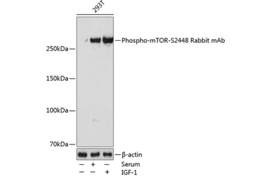 Western Blot - Anti-mTOR (phospho Ser2448) Antibody [ARC0094] (A308866) - Antibodies.com