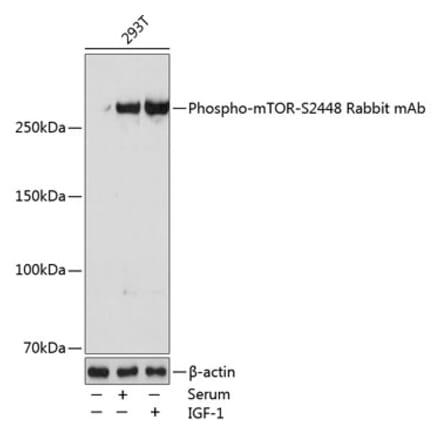 Western Blot - Anti-mTOR (phospho Ser2448) Antibody [ARC0094] (A308866) - Antibodies.com