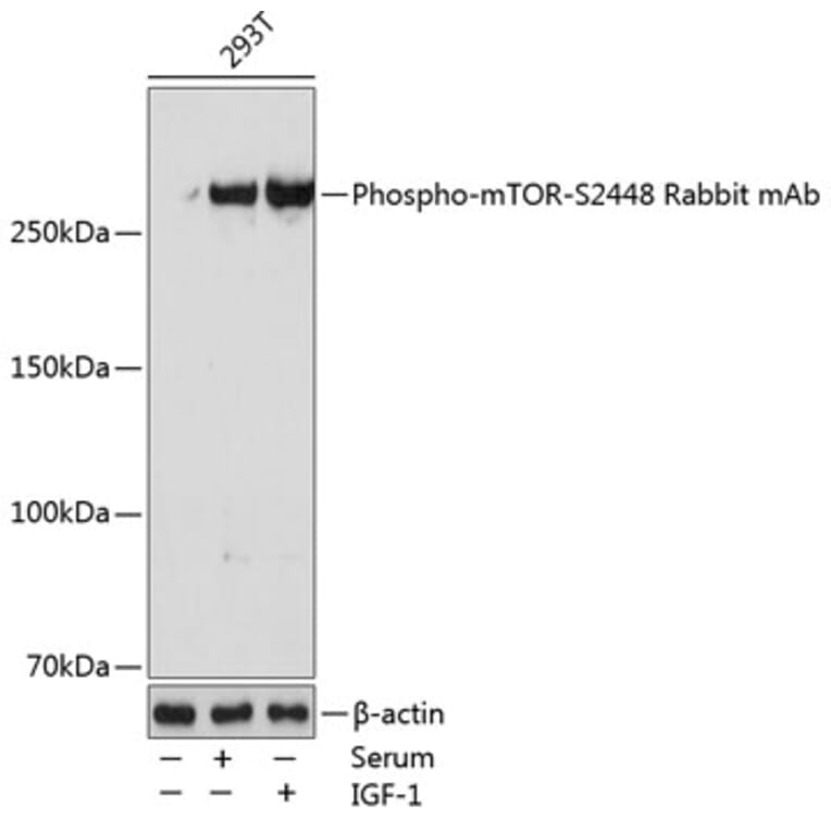 Western Blot - Anti-mTOR (phospho Ser2448) Antibody [ARC0094] (A308866) - Antibodies.com