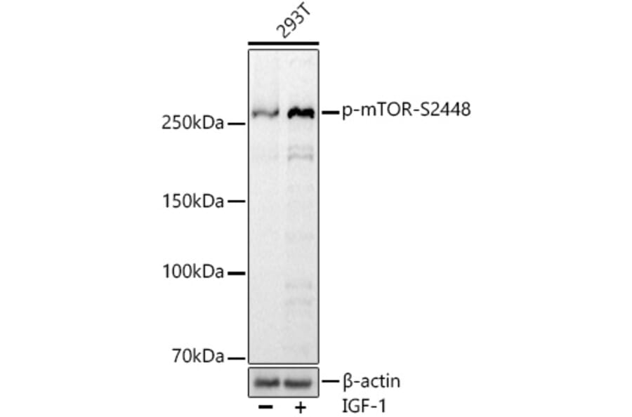 Western Blot - Anti-mTOR (phospho Ser2448) Antibody [ARC0094] (A308866) - Antibodies.com