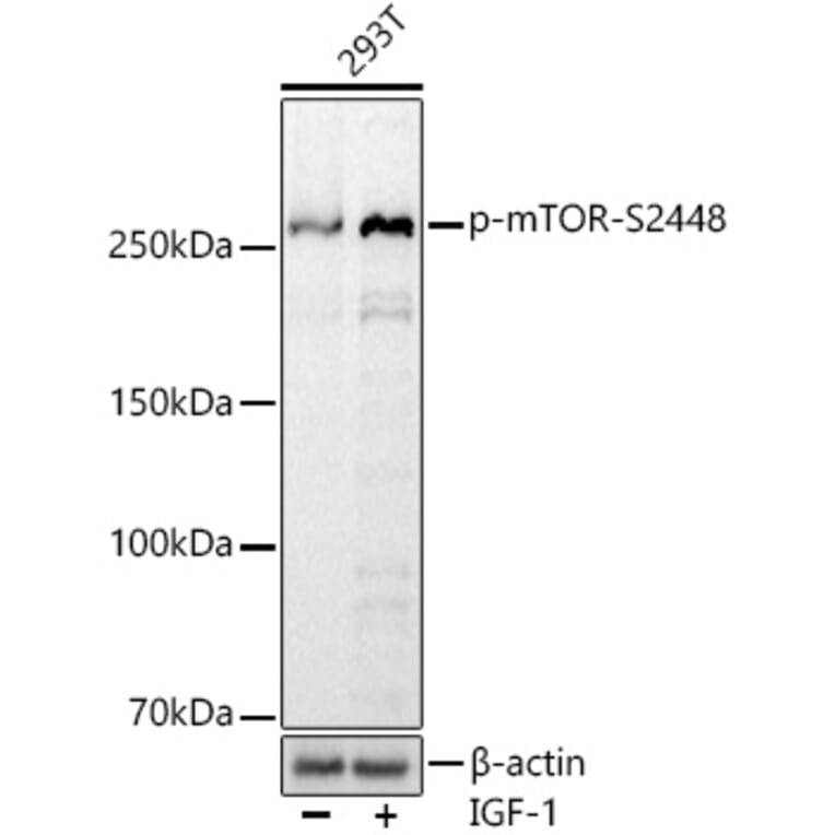 Western Blot - Anti-mTOR (phospho Ser2448) Antibody [ARC0094] (A308866) - Antibodies.com