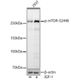Western Blot - Anti-mTOR (phospho Ser2448) Antibody [ARC0094] (A308866) - Antibodies.com