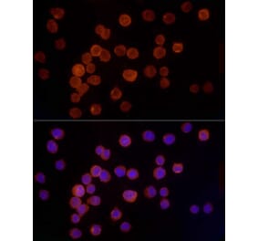 Immunofluorescence - Anti-Cathepsin G Antibody [ARC54789] (A308867) - Antibodies.com