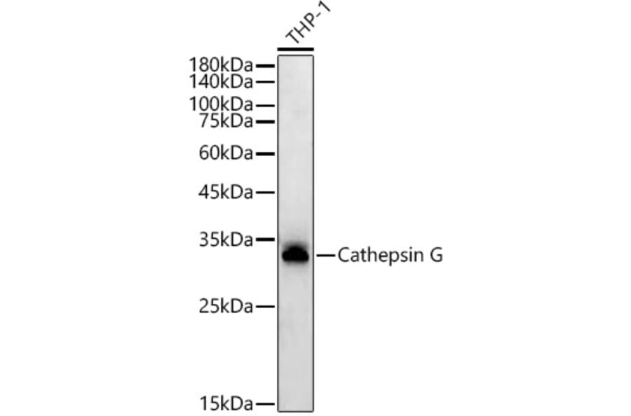 Western Blot - Anti-Cathepsin G Antibody [ARC54792] (A308868) - Antibodies.com