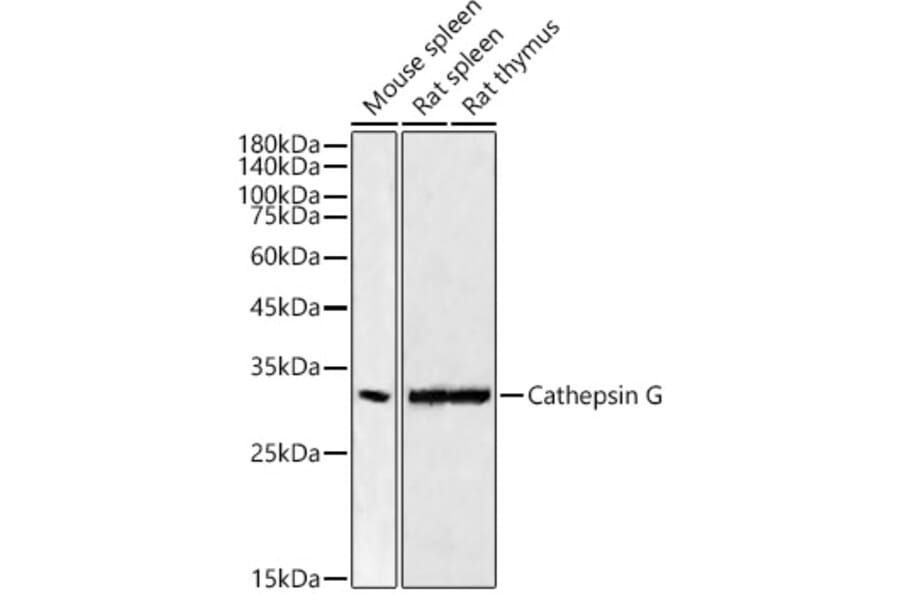 Western Blot - Anti-Cathepsin G Antibody [ARC54792] (A308868) - Antibodies.com
