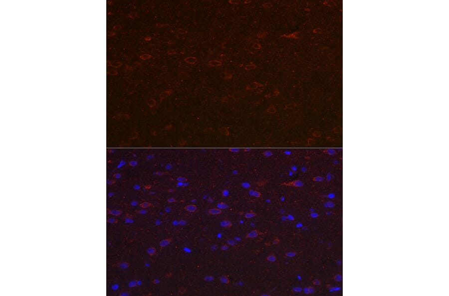 Immunofluorescence - Anti-Versican Antibody (A308869) - Antibodies.com