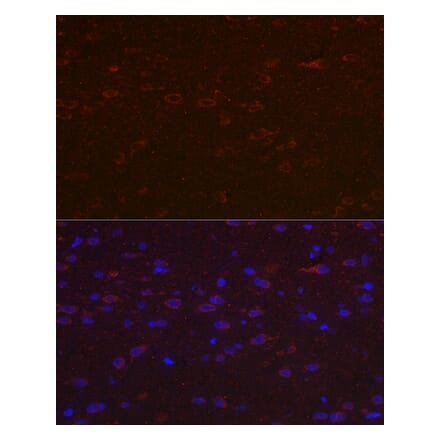 Immunofluorescence - Anti-Versican Antibody (A308869) - Antibodies.com