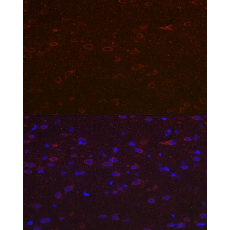 Immunofluorescence - Anti-Versican Antibody (A308869) - Antibodies.com