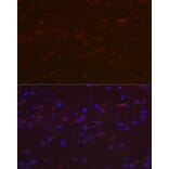 Immunofluorescence - Anti-Versican Antibody (A308869) - Antibodies.com