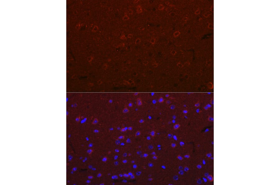 Immunofluorescence - Anti-Versican Antibody (A308869) - Antibodies.com