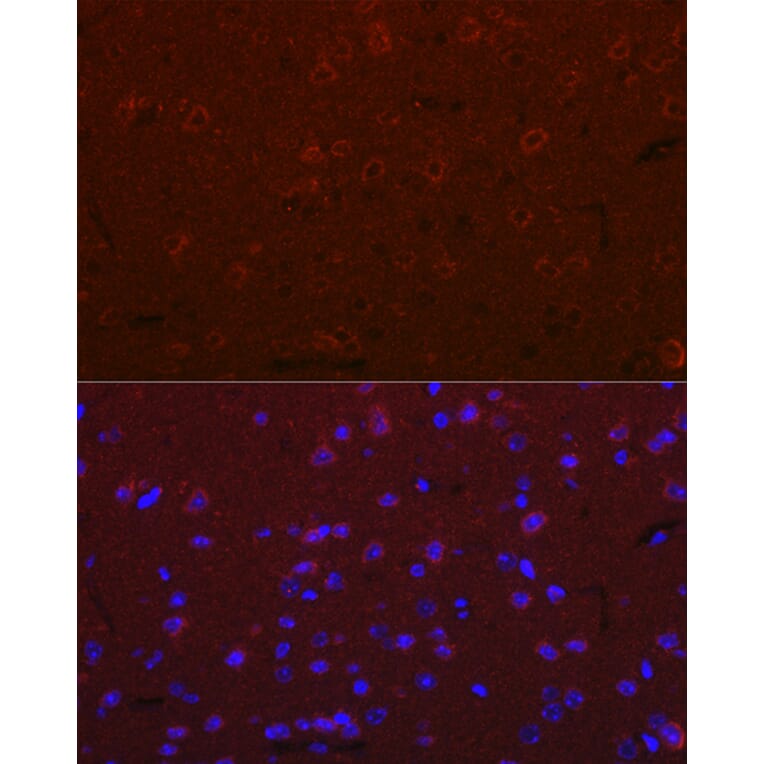 Immunofluorescence - Anti-Versican Antibody (A308869) - Antibodies.com