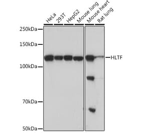 Western Blot - Anti-HLTF Antibody [ARC1982] (A308870) - Antibodies.com