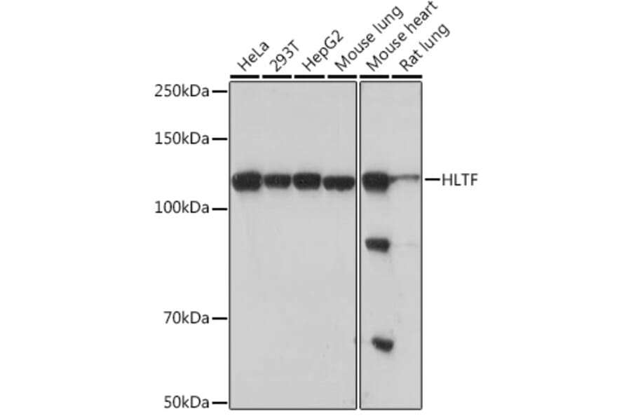 Western Blot - Anti-HLTF Antibody [ARC1982] (A308870) - Antibodies.com