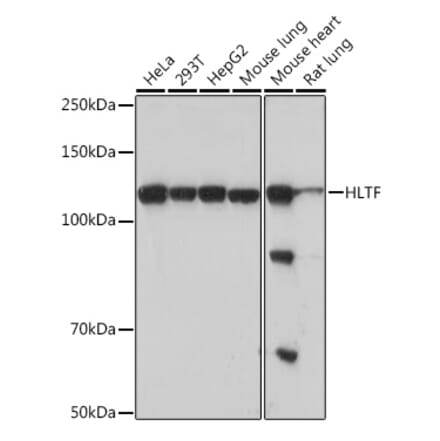 Western Blot - Anti-HLTF Antibody [ARC1982] (A308870) - Antibodies.com