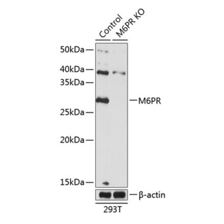 Western Blot - Anti-M6PR (cation dependent) Antibody (A308871) - Antibodies.com