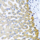 Immunohistochemistry - Anti-M6PR (cation dependent) Antibody (A308872) - Antibodies.com