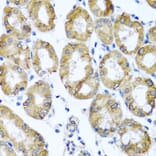 Immunohistochemistry - Anti-M6PR (cation dependent) Antibody (A308872) - Antibodies.com