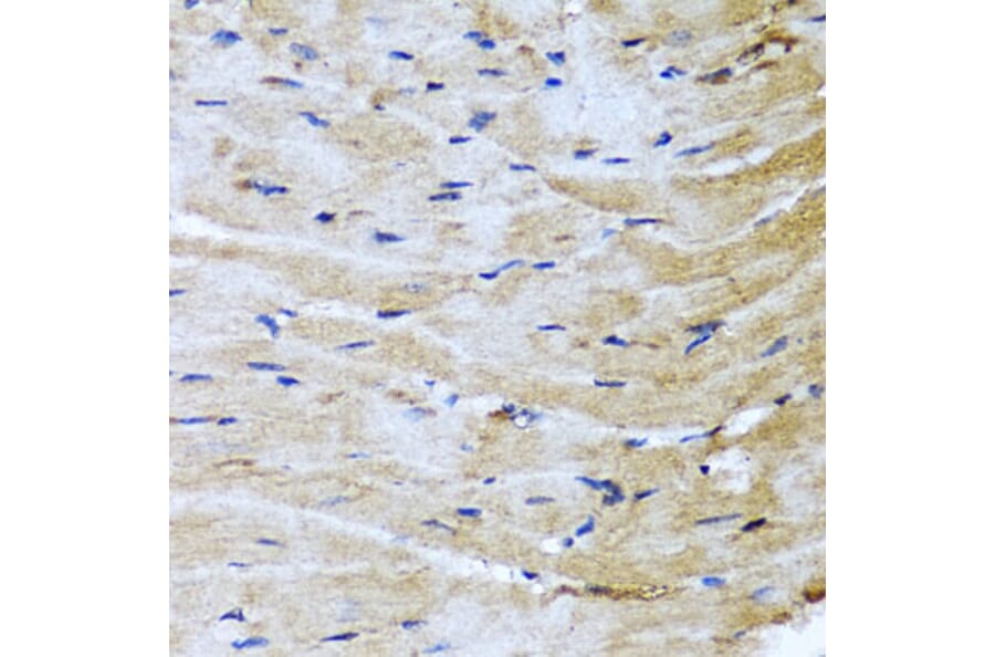 Immunohistochemistry - Anti-M6PR (cation dependent) Antibody (A308872) - Antibodies.com