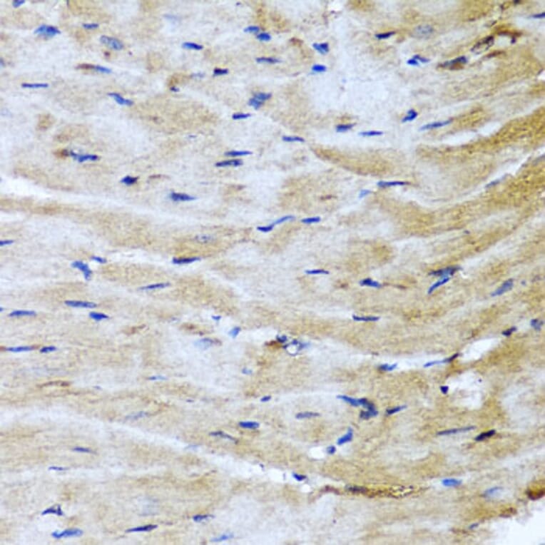 Immunohistochemistry - Anti-M6PR (cation dependent) Antibody (A308872) - Antibodies.com