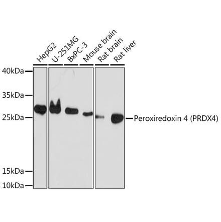 Western Blot - Anti-Peroxiredoxin 4 Antibody (A308874) - Antibodies.com