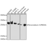 Western Blot - Anti-Peroxiredoxin 4 Antibody (A308874) - Antibodies.com