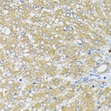 Immunohistochemistry - Anti-Peroxiredoxin 4 Antibody (A308874) - Antibodies.com