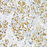 Immunohistochemistry - Anti-Peroxiredoxin 4 Antibody (A308874) - Antibodies.com
