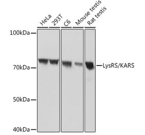 Western Blot - Anti-LysRS Antibody [ARC1765] (A308875) - Antibodies.com
