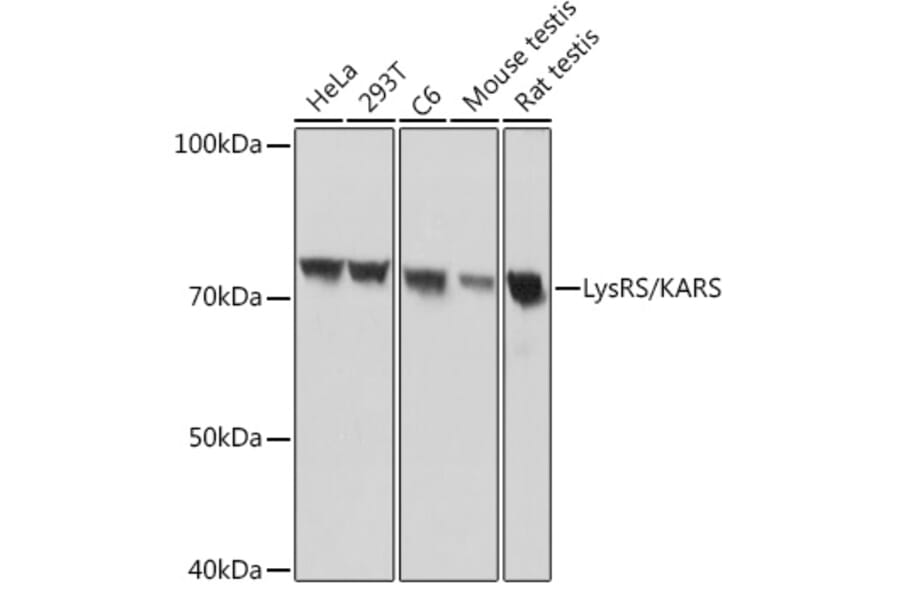 Western Blot - Anti-LysRS Antibody [ARC1765] (A308875) - Antibodies.com