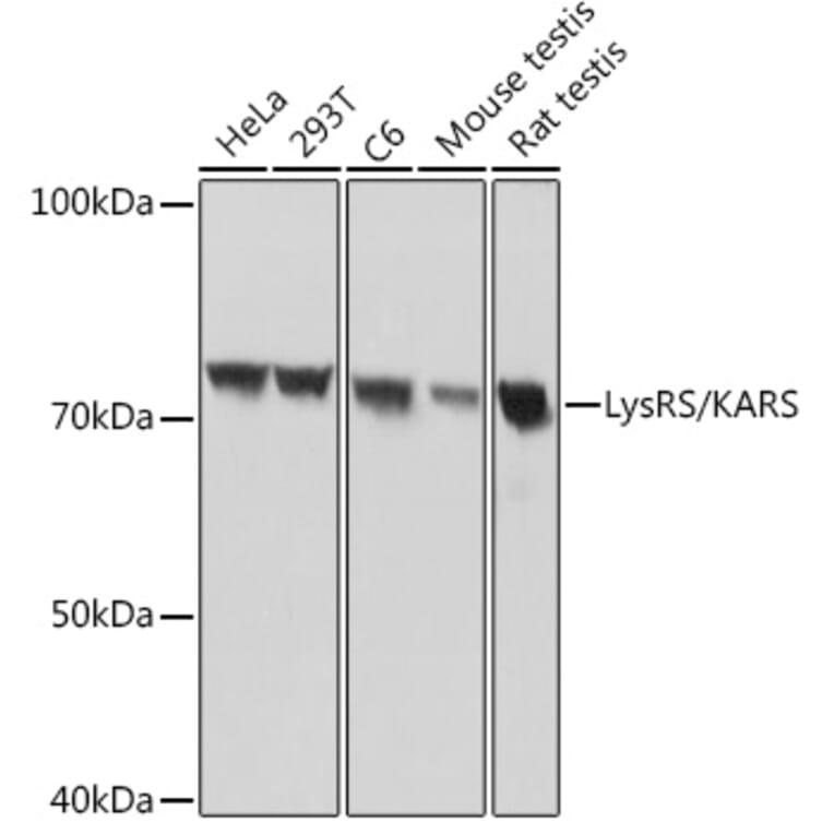 Western Blot - Anti-LysRS Antibody [ARC1765] (A308875) - Antibodies.com