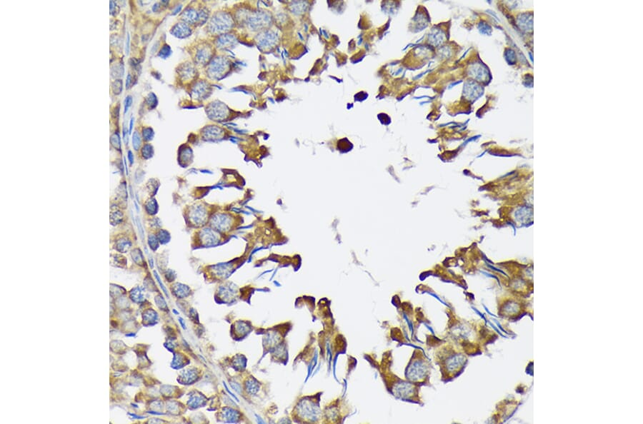 Immunohistochemistry - Anti-LysRS Antibody [ARC1765] (A308875) - Antibodies.com