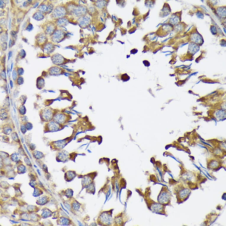 Immunohistochemistry - Anti-LysRS Antibody [ARC1765] (A308875) - Antibodies.com