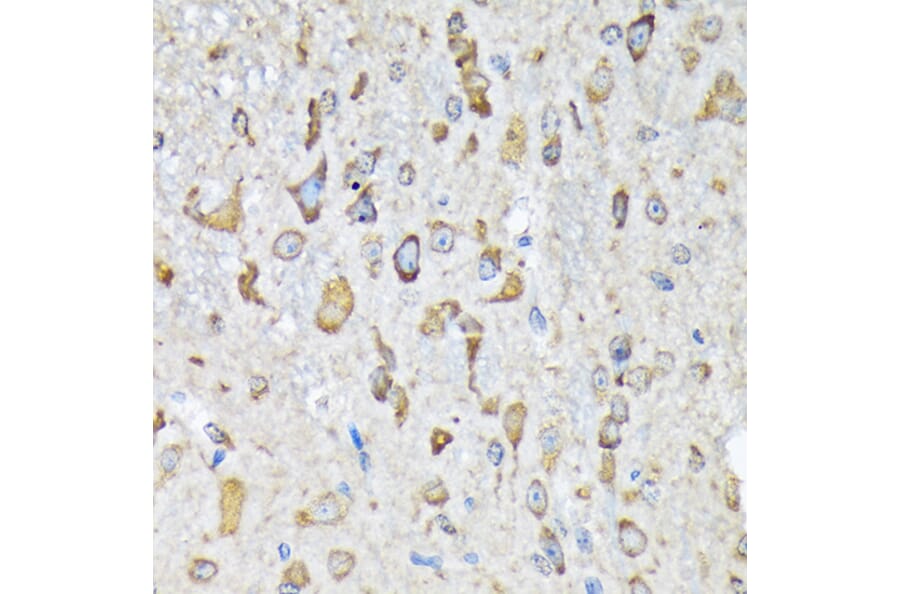 Immunohistochemistry - Anti-LysRS Antibody [ARC1765] (A308875) - Antibodies.com
