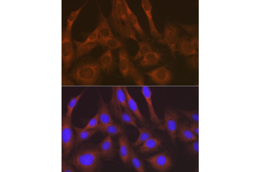 Immunofluorescence - Anti-LysRS Antibody [ARC1765] (A308875) - Antibodies.com