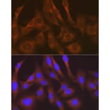 Immunofluorescence - Anti-LysRS Antibody [ARC1765] (A308875) - Antibodies.com