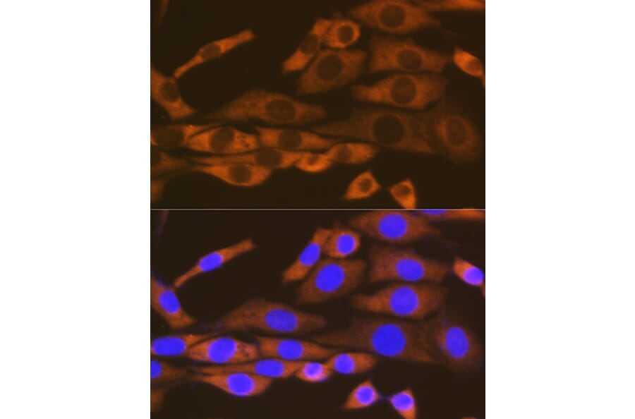 Immunofluorescence - Anti-LysRS Antibody [ARC1765] (A308875) - Antibodies.com