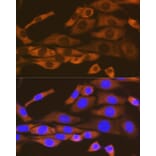 Immunofluorescence - Anti-LysRS Antibody [ARC1765] (A308875) - Antibodies.com