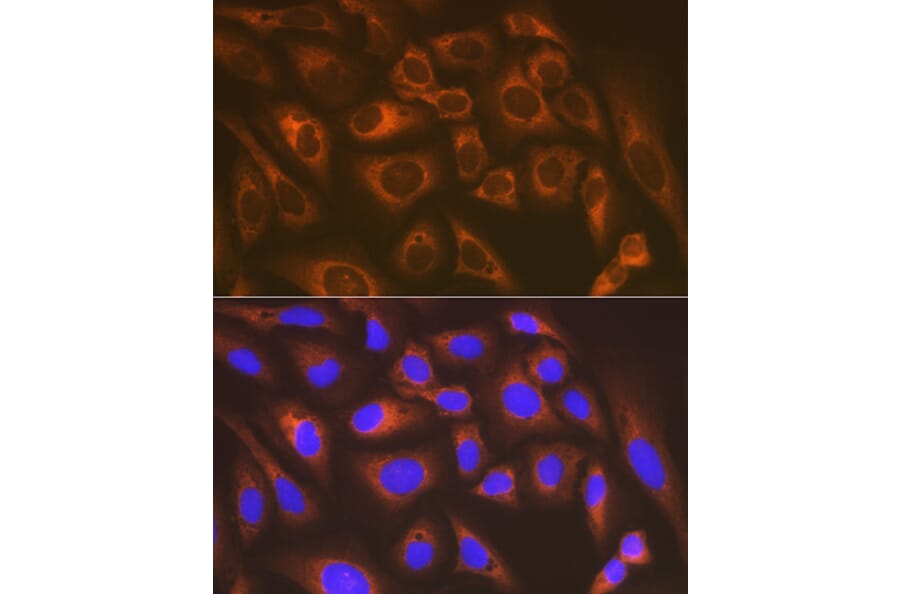 Immunofluorescence - Anti-LysRS Antibody [ARC1765] (A308875) - Antibodies.com