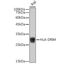Western Blot - Anti-HLA-DRB4 Antibody (A308876) - Antibodies.com