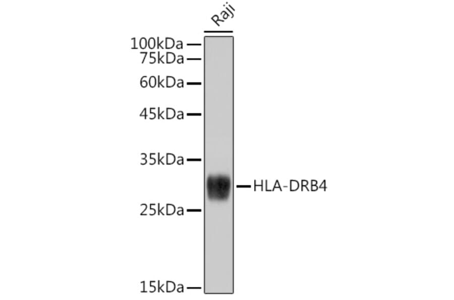 Western Blot - Anti-HLA-DRB4 Antibody (A308876) - Antibodies.com
