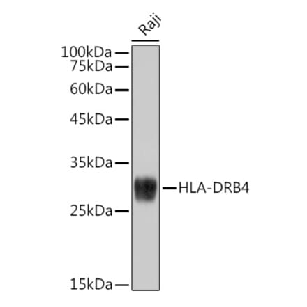 Western Blot - Anti-HLA-DRB4 Antibody [ARC2505] (A308876) - Antibodies.com