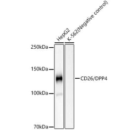 Western Blot - Anti-DPP4 Antibody [ARC59223] (A308877) - Antibodies.com