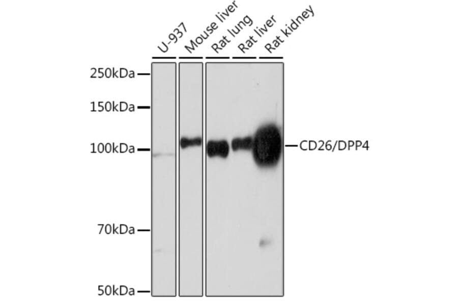 Western Blot - Anti-DPP4 Antibody [ARC0939] (A308878) - Antibodies.com